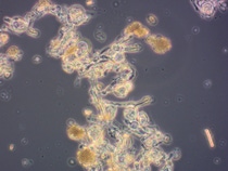 The microorganisms used in the new plant include the fungus Penicillium coprobium, which is fermented to produce the direct precursor of the insecticide Inscalis®. The picture shows the fungal cells in its fermentation broth.  Photo: BASF SE