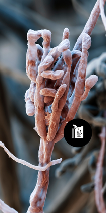 Ein Gliocladium Pilz. Ein Gliocladium Pilz.